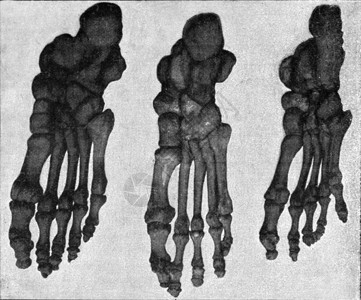 日本人脚骨架的比较表欧洲人和澳大利亚刻有古老的画190年宇宙与人类图片