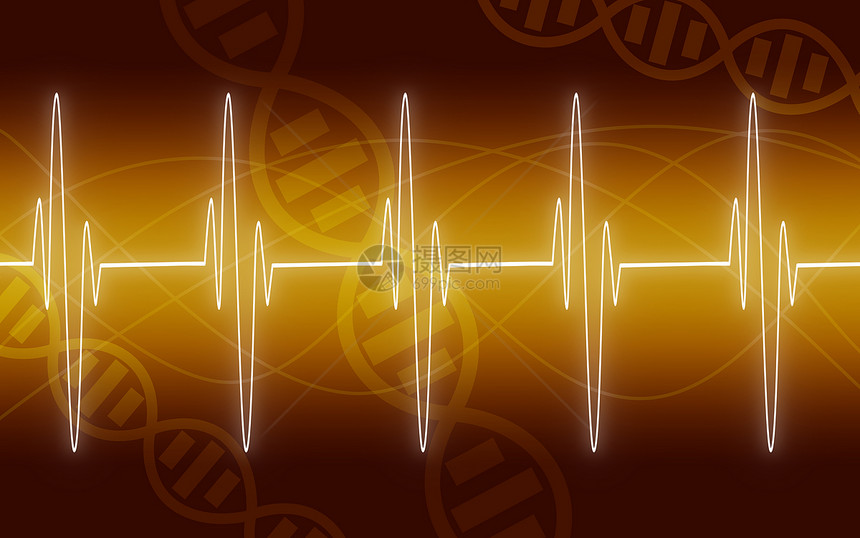 EKG黄色背景的跟踪3D转化图片