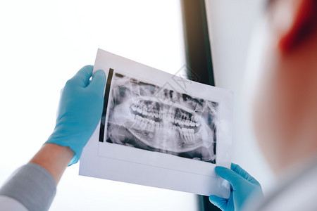 亚洲男牙医正在分析实验室病人的X光图像图片
