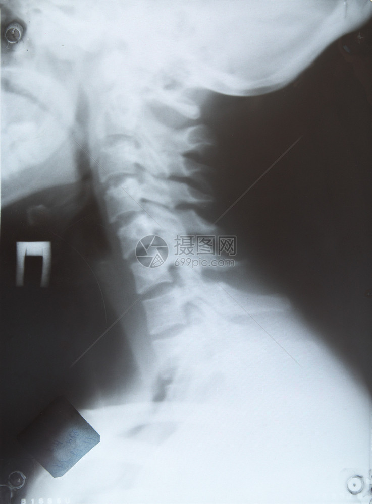 RX颈部诊断设计要素图片