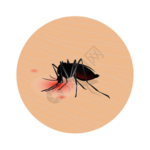 误吸蚊子咬皮肤喝血吸害虫插图插画