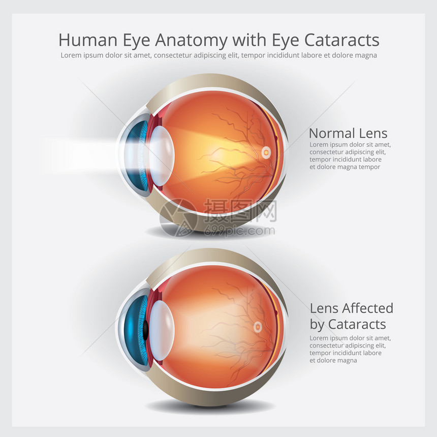 人类眼解剖矢量说明图片