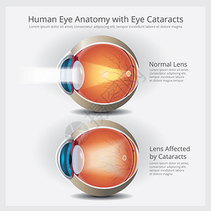 人类眼解剖矢量说明背景图片