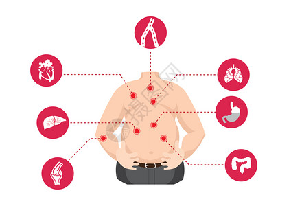 腹部脂肪关于医疗和保健的图表风格说明插画