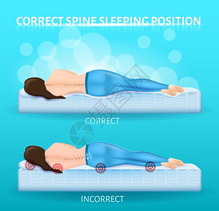 床垫弹簧造成脊柱疼痛或姿势脱节的正确和不睡眠位置插画