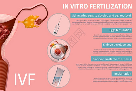 体外受精阶段刺激卵Embryo开发向Uretrus转移植入女生殖系统IVF病媒现实说明医疗封条复制空间背景图片