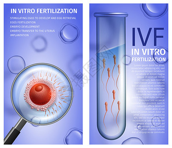 烧杯矢量具有复制空间的体外受精垂直医疗容器带有活Spermatozons的男测试管蓝背景女卵细胞放大镜视图IVF矢量现实一说明背景