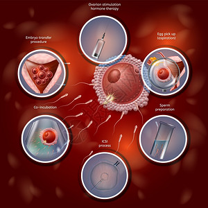 活化肥体成像学通过人工合并拉比迪什的鸡蛋和Sperm进行肥化过程然后将Embryo转基因至Uterus矢量现实说明IVF医疗银行插画