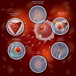 六学体活化肥体成像学通过人工合并拉比迪什的鸡蛋和Sperm进行肥化过程然后将Embryo转基因至Uterus矢量现实说明IVF医疗银行插画