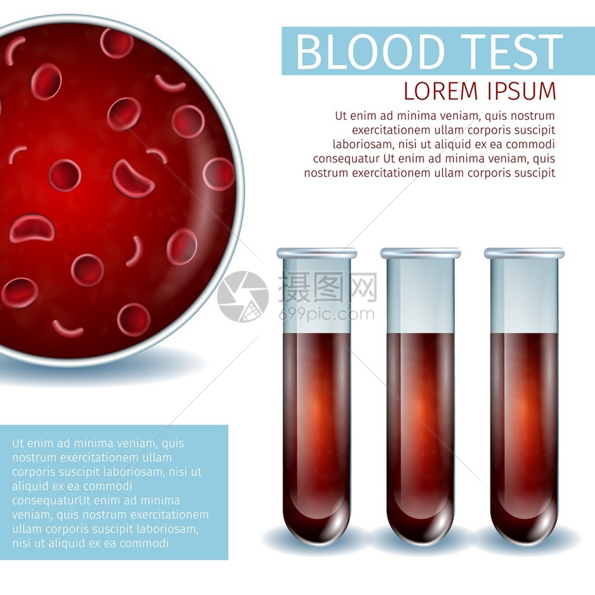 含有血红色细胞的宏视图以及带有液体血样本的一组实验室玻璃管子真实的矢量说明带有复制空间的广场血热医学禁闭器血液医学禁闭器复制空间图片