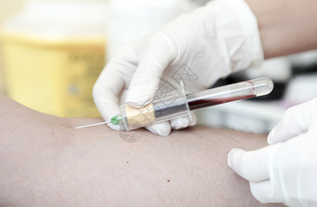医生针头血液测试是对样本进行的实验室分析血液样本通常使用皮下针头或通过指从手臂的血管中提取背景