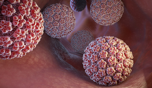 三维人素材人类瘤病毒(HPV)是瘤病毒家族的DNA病毒。背景