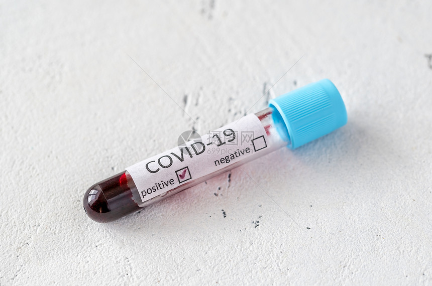 新冠19测试的血液样本管阳图片