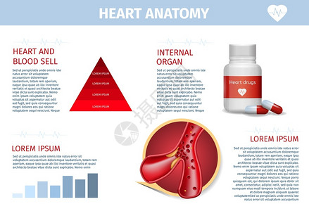 心肌供血不足心脏药物和外科治疗方法插画
