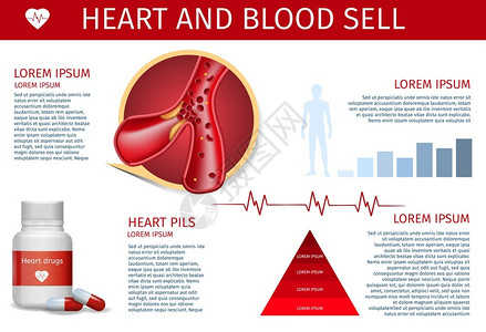 药物创新循环系统和心脏治疗预防人类心血管疾病治疗方法的工作特征人体心血管疾病治疗和预防方法插画