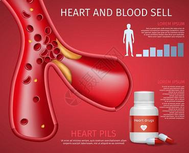 脉管的红色动脉硬化药物矢量设计背景插画
