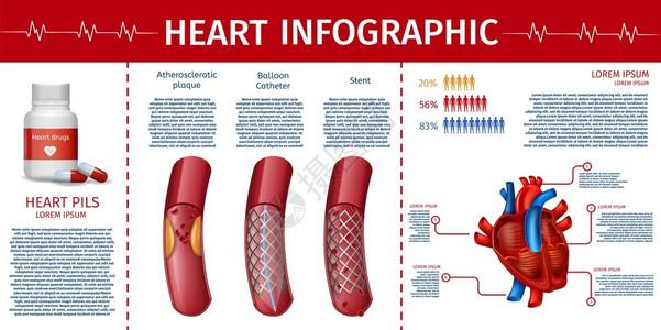 杂志插页实际心血管特征和统计与药片清单和外科禁闭室的心血管治疗保健和预防方法手册医疗诊所着陆说明心血管治疗插页心血管治疗插画