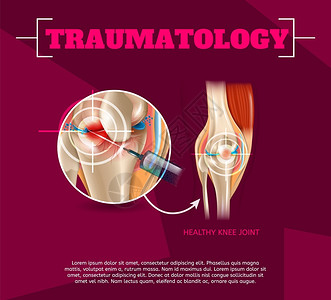 日式豚骨面海报3dVectorBanner图像解剖人体膝盖联合治疗Osteoarthritis注射药物方法健康膝盖联合治疗结果插画