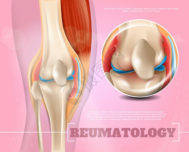 风湿病学医学医学的高清图片