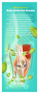 品牌联合应用医疗胶片治后现实的3d矢量解剖人体膝盖联合药用品牌广告海报插画