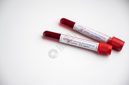 含有血液样本的清冠状新冠19管的存在血液测试样本已经检测出冠状呈阳图片