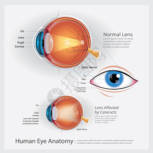 黄斑人类眼球解剖矢量说明插画