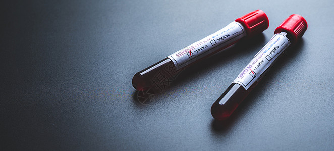 人体分析药物测试管中的新冠na新冠19血液测试研制疫苗和抗病物的科学实验室以及人体检测背景
