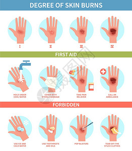 手伤烧伤程度热急救红皮肤烧伤和泡紧急救助治疗指导热伤医南信息海报帮助诊所扁矢量测步骤热伤急救皮肤烧和泡紧急救助信息海报帮扁矢量测步骤插画