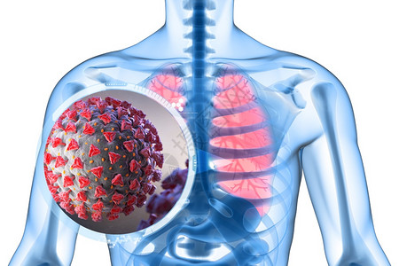 肺感染3D说明新冠是一种攻击呼吸道的病原体新冠是一种攻击呼吸道的病原体背景