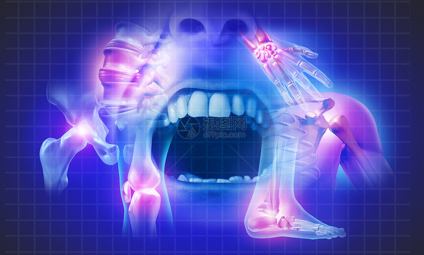 连结概念的疼痛是身体骨骼和肌肉解剖有一组疼痛关节作为苦的伤或关节炎疾病象征作为保健的象征有3D插图的医学症状图片