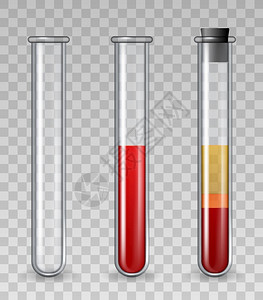 血小板减少带血液的试验管现实玻璃医疗管装满红色细胞血浆丰富的小板PRP皮肤治疗矢量组说明药理学和治疗科化的试验管有血液的试验管现实玻璃医疗插画