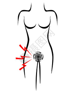 带有止痛点膀胱的典型女身体高清图片