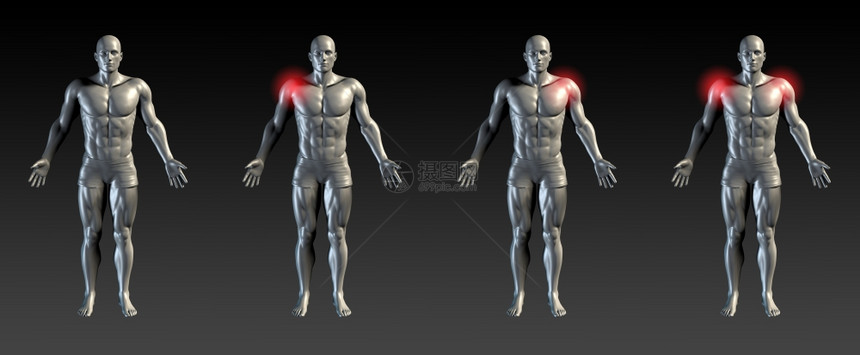 区域系列上红色光照的肩部伤害图片
