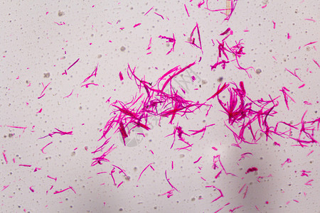 子宫肌瘤显微镜下的滑动肌肉分离白色背景的粉红线条摘要背景