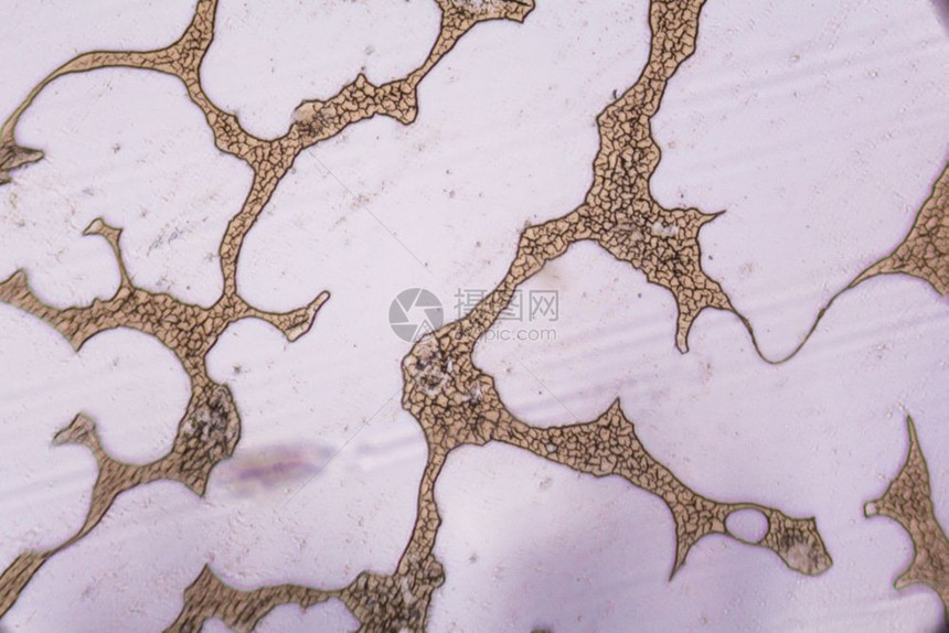 显微镜下的凝聚血细胞图片