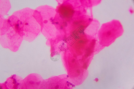 显微镜下的多孔相上白色背景上的粉红点摘要背景图片