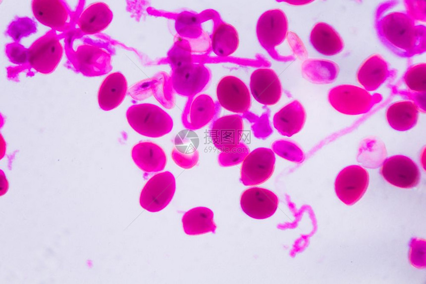 显微镜下的血梅卡利斯塞克林娜亚ther成熟白色背景的粉红点摘要图片