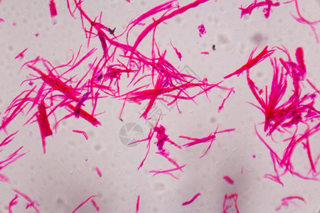 显微镜下的滑动肌肉分离白色背景的粉红线条摘要图片