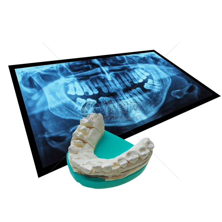 人体牙齿的医学X光成像和阳牙科造模的正复制成像这些由对白上孤立的牙齿负面印象而成图片