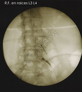 扎根的根底脊椎射电图背景