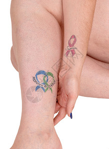 一个女人的腿部和手臂上红色蓝和绿的听觉纹身记着癌症与白色背景隔绝图片