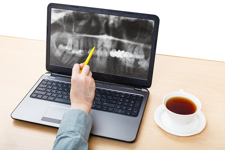 牙医分析笔记本电脑屏幕下巴X光照片图片
