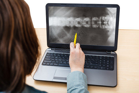 学生分析笔记本电脑屏幕上脊椎X光照片背景图片