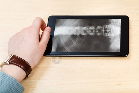 科学家分析平板电脑屏幕上脊椎柱的X射线图片图片