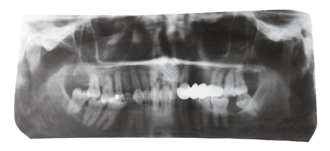 白色背景孤立的人体牙齿照片图片