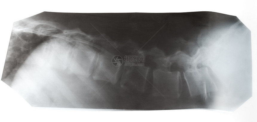 白色背景隔离的人类脊椎柱X光照片图片
