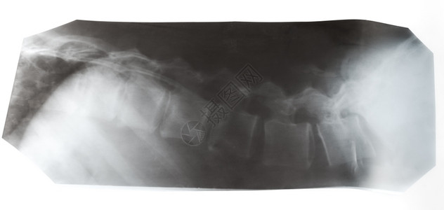 白色背景隔离的人类脊椎柱X光照片图片