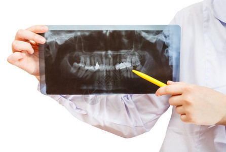 护士持有X光照片将白底的人类下巴隔离开来图片