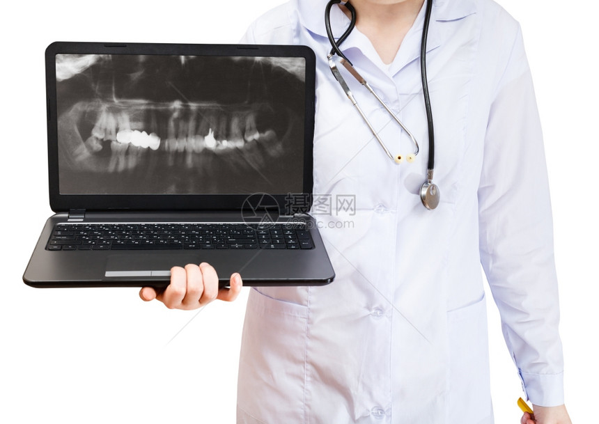 护士在白色背景隔离的屏幕上持有电脑笔记本和X光照片图片