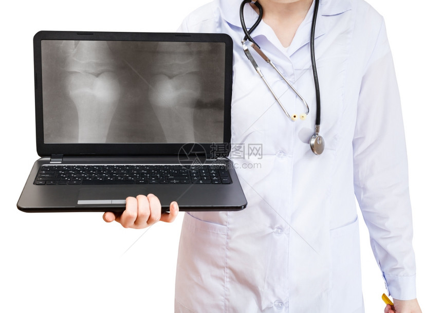 护士在白色背景隔离的屏幕上持有电脑笔记本有人类膝盖合X光照片图片